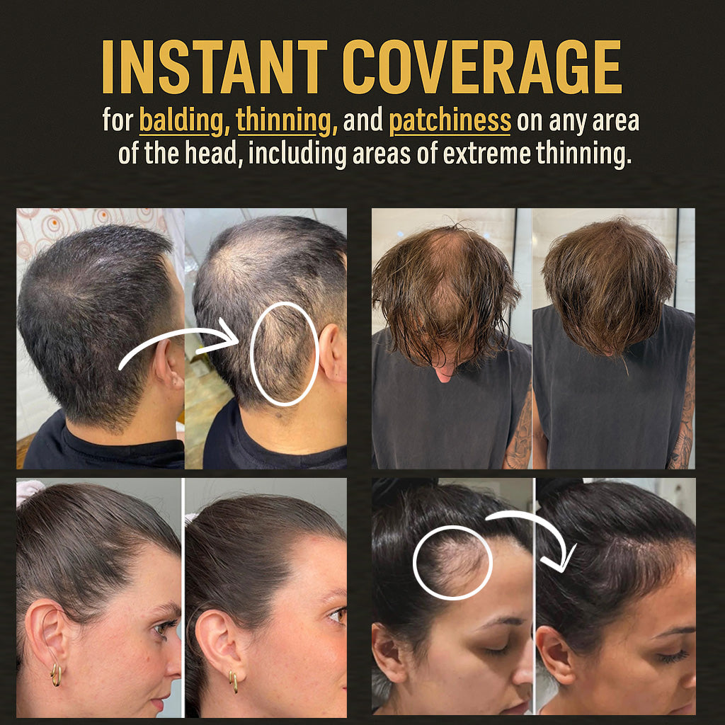 Hair Density Filler